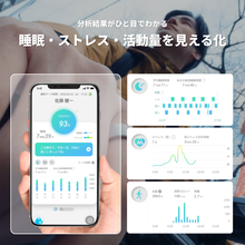 画像をギャラリービューアに読み込む, スマートリカバリーリング .